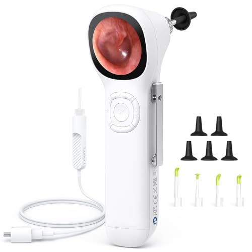 Amazon US: ScopeAround Digital Otoscope w/IPS Screen