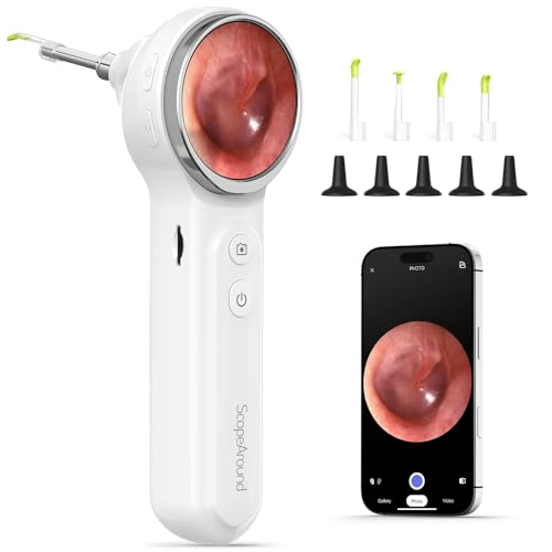Amazon US: ScopeAround Otoscope with Light, Digital Otoscope w/1.85in IPS Screen