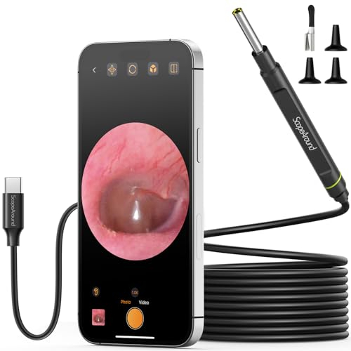Amazon US: ScopeAround Otoscope Ear Camera, Ear Wax Removal Tool 1080P Otoscope