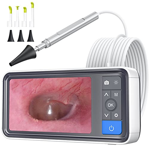 Amazon US: ScopeAround Otoscope Ear Camera with 4.5