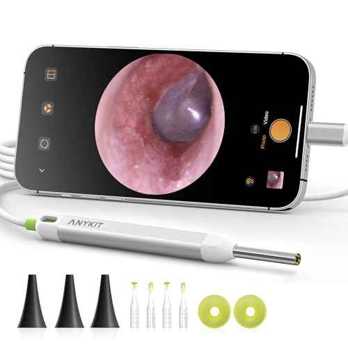 Amazon US: Anykit Visual Ear Wax Removal Camera